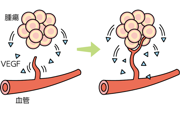 腫瘍から放出されたVEGFによって、血管から腫瘍へと新しい血管が伸びていく様子を示すイラスト