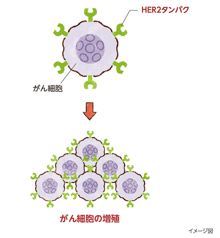 がん細胞の増殖を促す信号物質のセンサーの役割をもつHER2タンパクをたくさんもつがん細胞では、がん細胞が増え続けてしまいます。