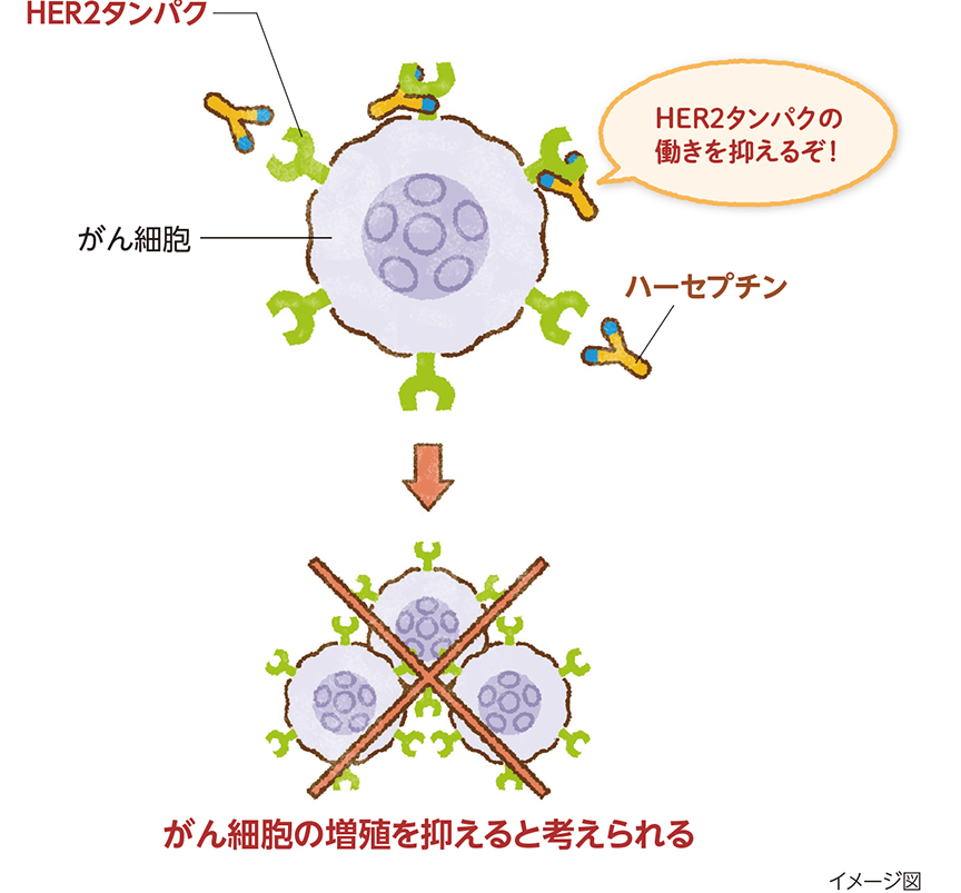 がん細胞にあるHER2タンパクを標的とするハーセプチンがHER2タンパクに結合し、センサーが働かないようにすることで、がん細胞の増殖を促す信号物質を受け取りにくくします。